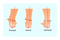 Understanding Types of Pronation