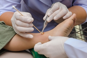 Diabetes Inhibits Foot Wound Healing